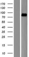ALDH16A1 Protein (Over-Expression Lysate Myc-DDK (Flag))