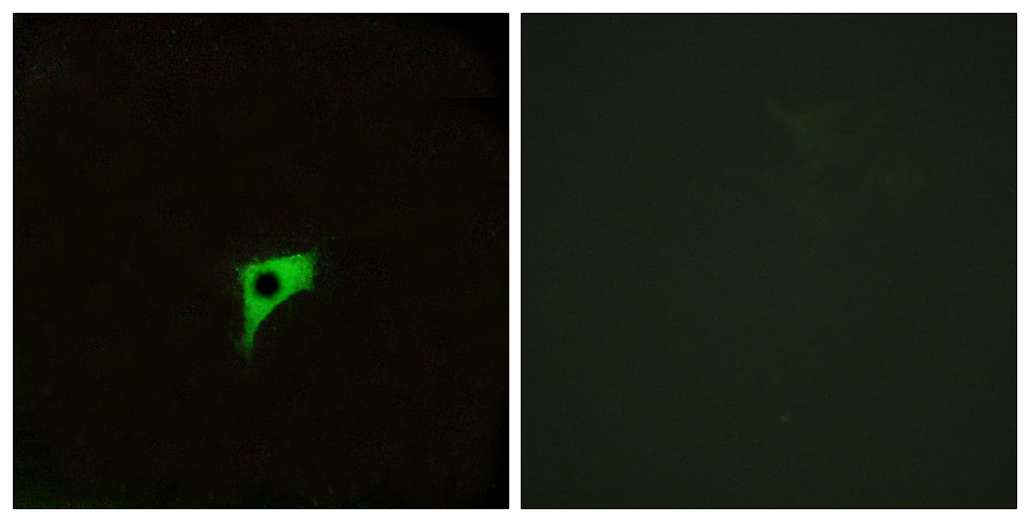 CHRM2 / M2 Antibody (aa185-234)