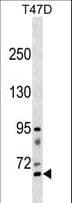 Polyclonal Rabbit anti-Human RHPN2 Antibody (aa352-380, WB)