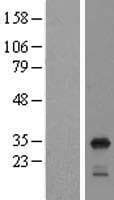 RPL8 / Ribosomal Protein L8 (Over-Expression Lysate Myc-DDK (Flag))