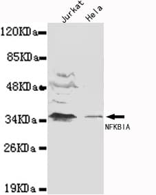 NFKBIA / IKB Alpha / IKBA Antibody (N-Terminus)