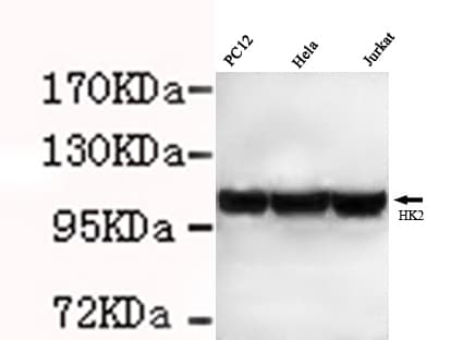 HK2 / Hexokinase 2 Antibody (N-Terminus)