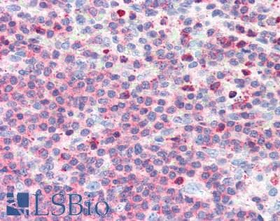 Lymphotoxin-Beta / LTB Antibody (aa58-304)