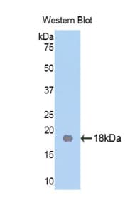 BMI1 / PCGF4 Antibody (aa152-289)