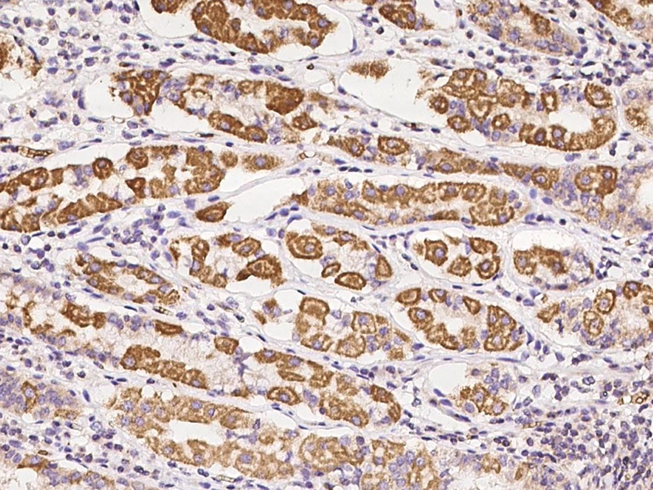 APOBEC3D Antibody