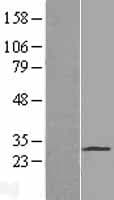 PAQR4 Protein (Over-Expression Lysate Myc-DDK (Flag))