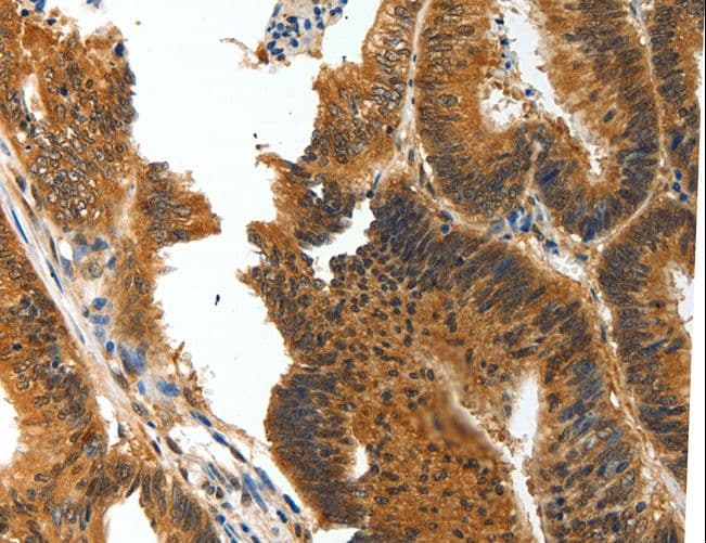 BRUCE / BIRC6 Antibody