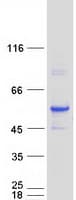Human ALDH3A2 Protein (Recombinant Myc-DDK (Flag))