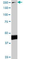 IHC-plus™ TLN1 / Talin 1 Antibody (clone 1A11)