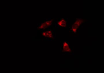 MAPK9 / JNK2 Antibody