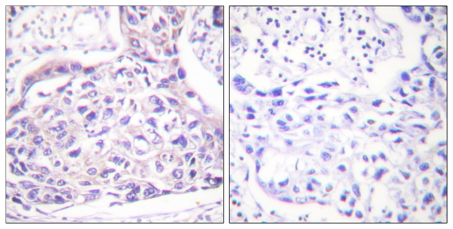 IRS1 Antibody (phospho-Ser323)