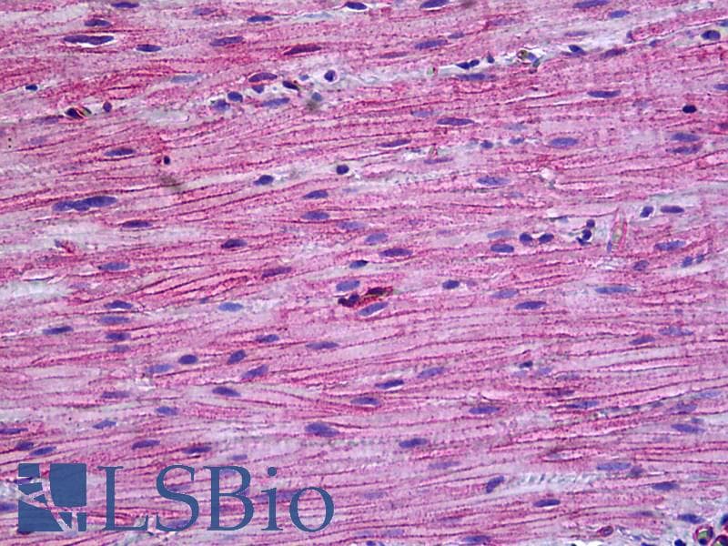 IHC-plus™ PPP3CA / CCN1 / Calcineurin A Antibody (aa21-51)