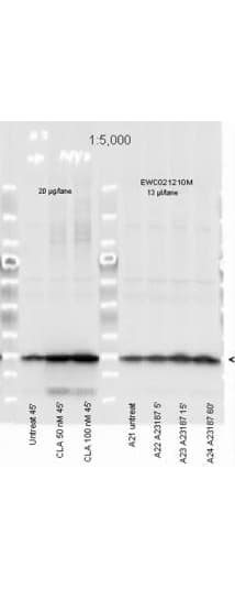 Polyclonal Rabbit anti-Human MYL12A / MRCL3 Antibody (phospho-Ser19/20, IHC, WB)