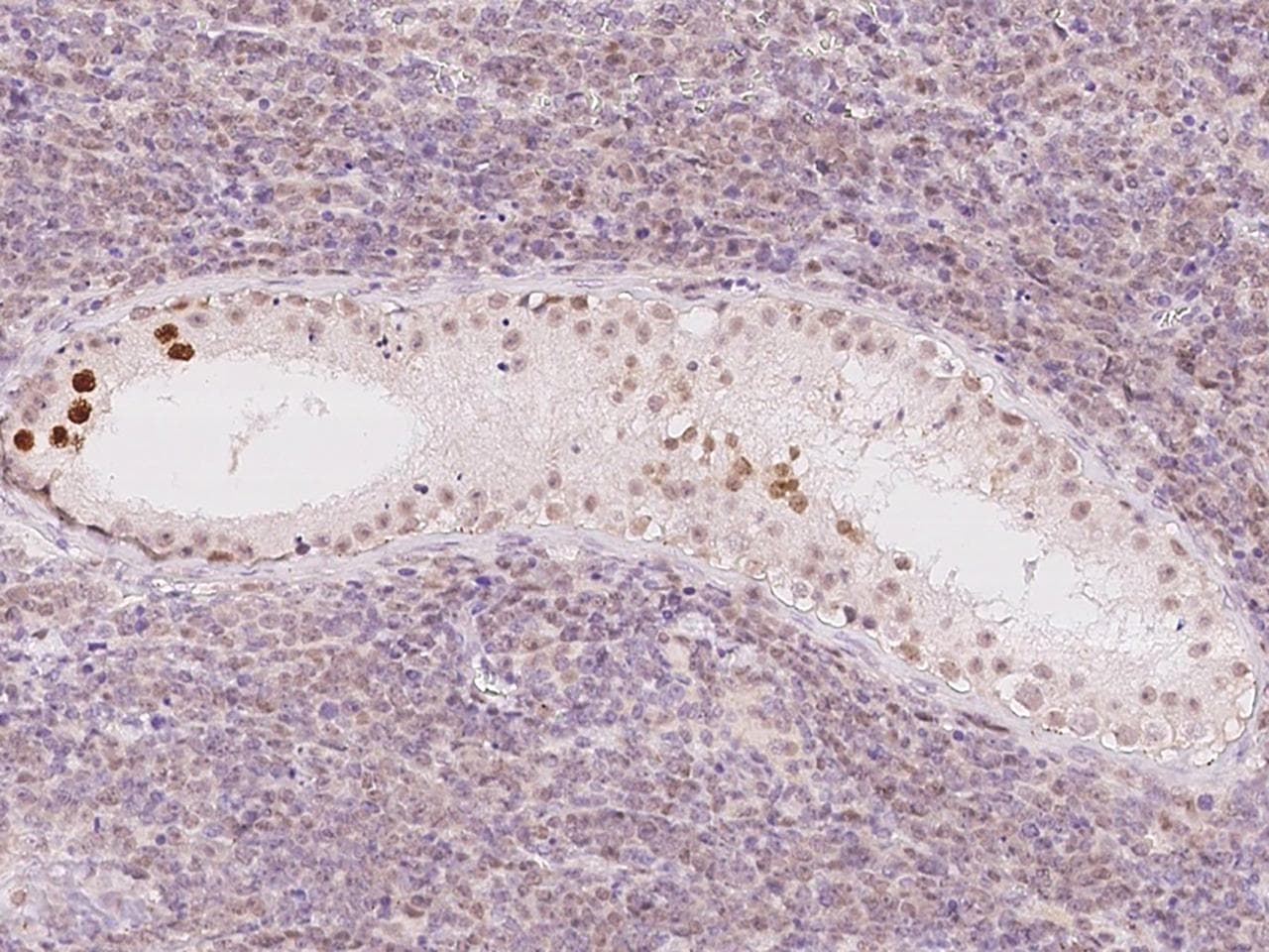 SYCP3 / SCP3 Antibody