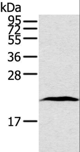 Polyclonal Rabbit anti-Human TAF10 Antibody (IHC, WB)