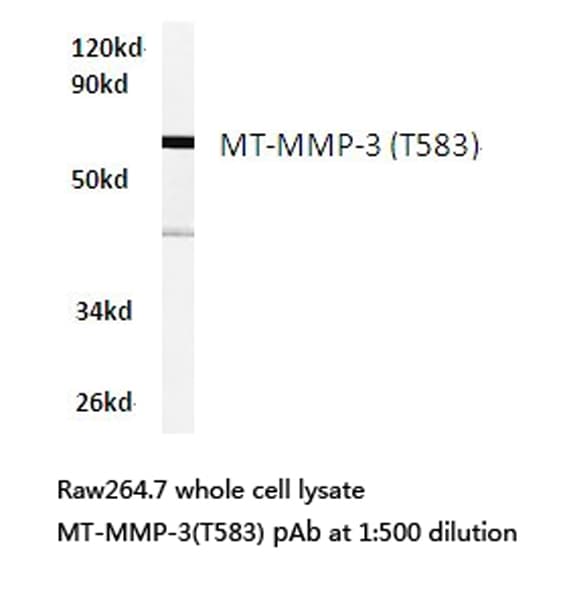 Polyclonal Rabbit anti-Human MMP16 Antibody (Thr583, IHC, WB)