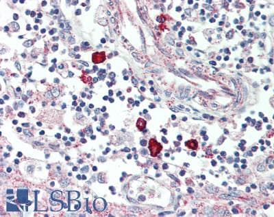 IHC-plus™ CDS1 Antibody (clone 2D10)