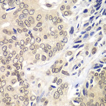 RNF2 / RING2 / RING1B Antibody