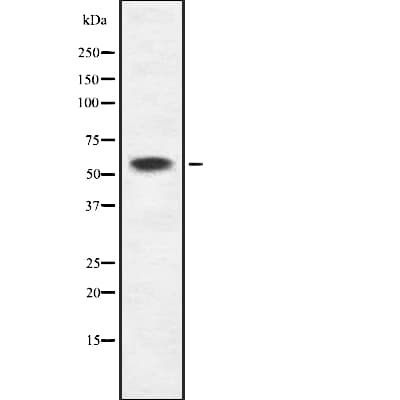 KRT6C / CK6C / Cytokeratin 6C Antibody