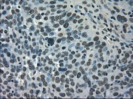 SATB1 Antibody (clone OTI4E1)