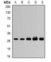 Polyclonal Rabbit anti-Human UQCRFS1 Antibody (IF, WB)