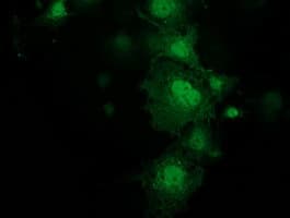 KCTD14 Antibody (clone OTI1D1, Carrier-free)