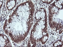 MYBPH Antibody (clone OTI3G1)