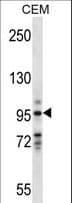 Polyclonal Rabbit anti-Human VAV1 / VAV Antibody (aa437-466, WB)