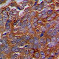 C5orf13 Antibody (Internal)