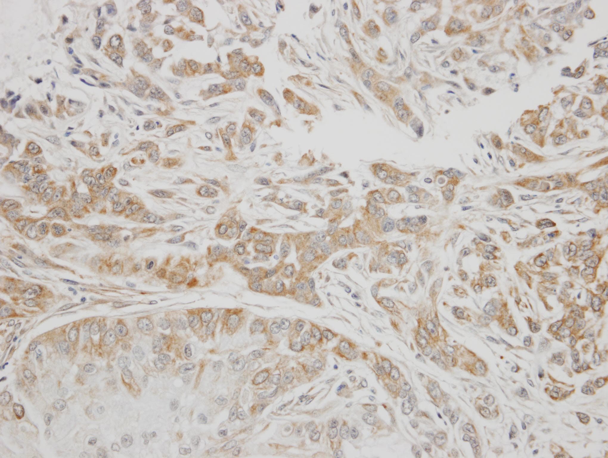 Polyclonal Rabbit anti-Human SERPING1 / C1 Inhibitor Antibody (aa77-420, IHC, WB)