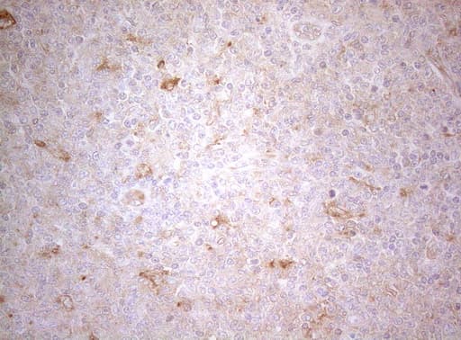TWF1 / PTK9 Antibody (aa140-384, clone OTI5C12, Carrier-free)