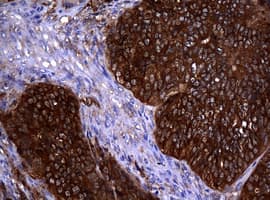 NME1 / NM23 Antibody (clone OTI2H10)