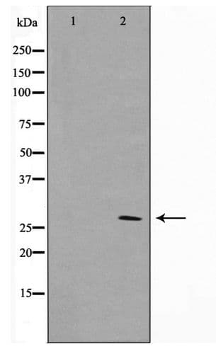 YWHAZ / 14-3-3 Zeta Antibody