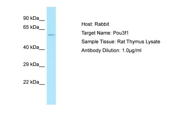 POU3F1 / OCT6 Antibody (aa361-410)