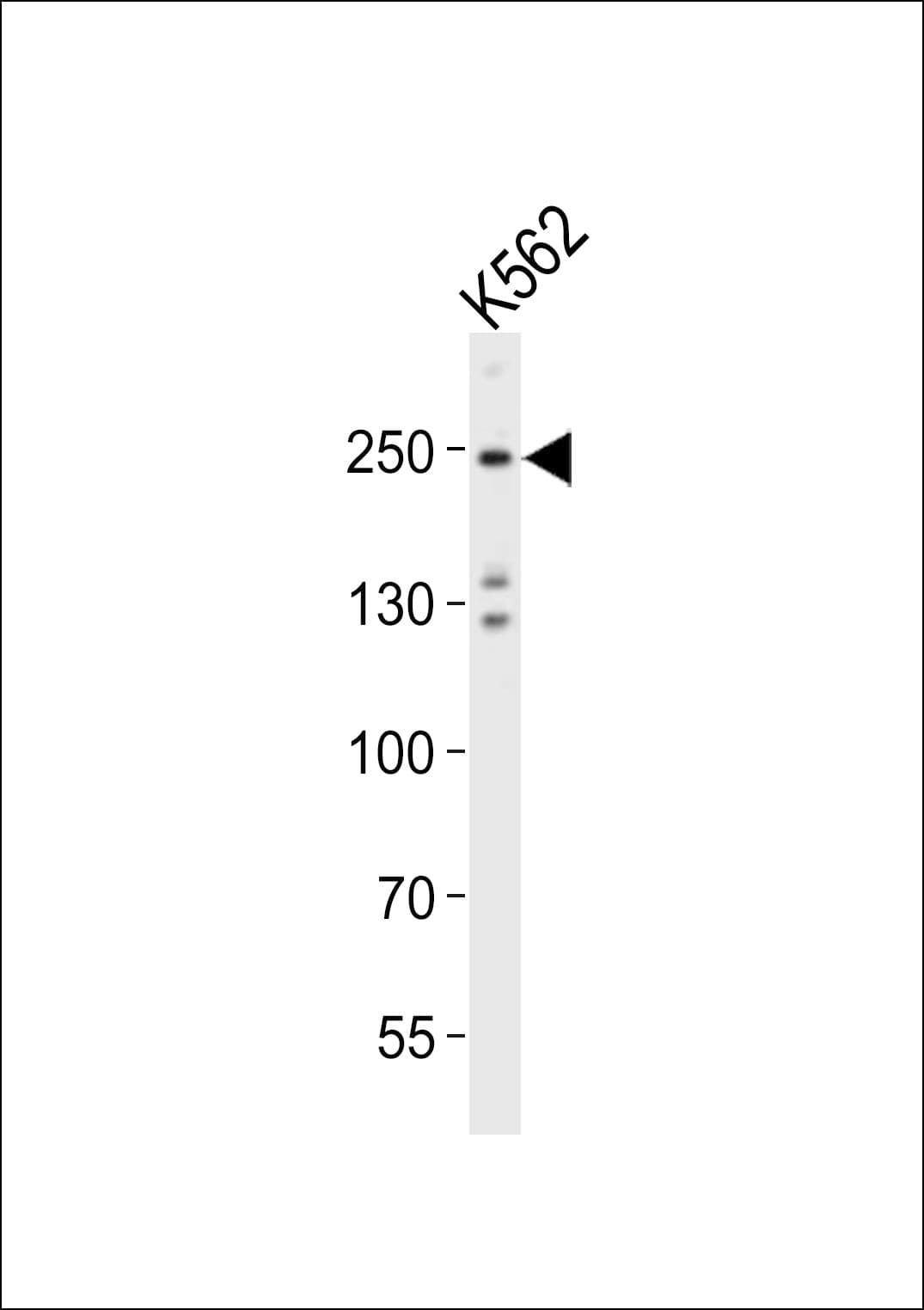 DNMT / DNMT1 Antibody (aa881-914)