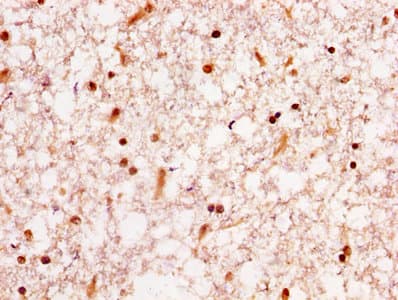 HNRPA1 / HnRNP A1 Antibody