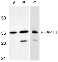 PHAP III / ANP32E Antibody (C-Terminus)