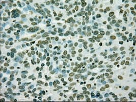 Monoclonal Mouse anti-Human PMEL / SILV / gp100 Antibody (clone OTI10E5, IHC, IF, WB)