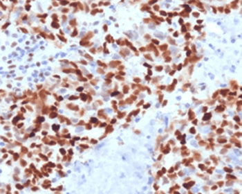 MSH6 Antibody (clone MTS6-1, Azide-free, BSA-free)