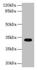 Polyclonal Rabbit anti-Human CYB5R2 Antibody (IHC, WB)