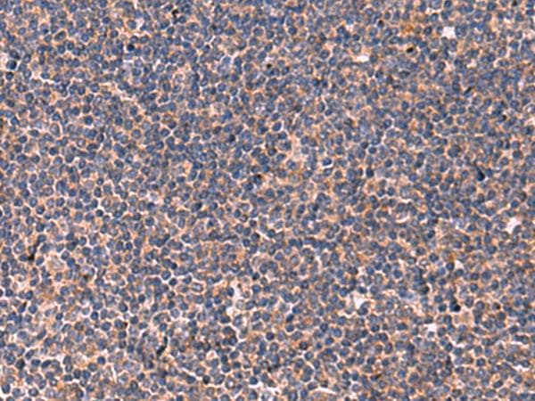 Polyclonal Rabbit anti-Human JAM3 Antibody (IHC, WB)