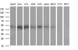ZSCAN21 / Zipro1 Antibody (clone OTI3B3)