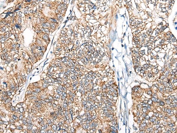 Polyclonal Rabbit anti-Human NADK2 / C5orf33 Antibody (IHC, WB)