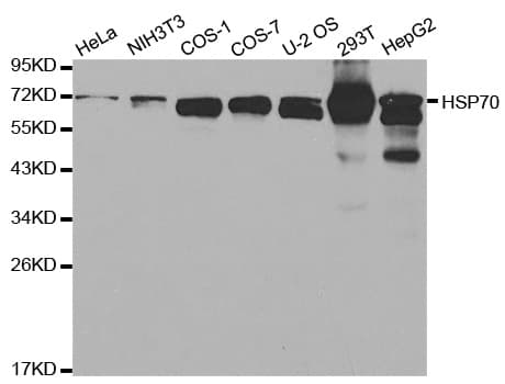 IHC-plus™ Polyclonal Rabbit anti-Human Heat Shock Protein 70 / HSPA1A Antibody (IHC, IF, WB)