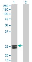PRL / Prolactin Antibody (clone 1E1)