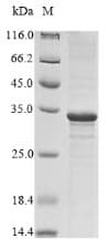 Vesicular Stomatitis Virus SARS-CoV Matrix Protein (Recombinant 6His, N-terminus)
