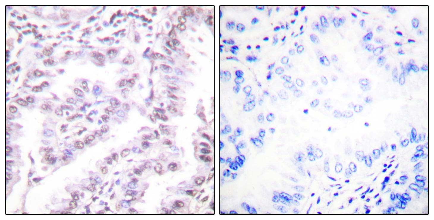 XRCC5 / Ku80 Antibody (p714)