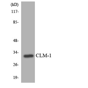 Polyclonal Rabbit anti-Human CD300LF / CD300f Antibody (aa44-93, WB)