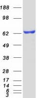 Human ER Alpha / Estrogen Receptor Protein (Recombinant Myc-DDK (Flag))