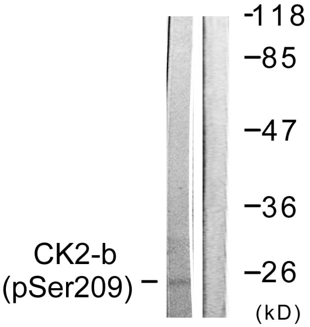 Polyclonal Rabbit anti-Human CSNK2B / Phosvitin Antibody (phospho-Ser209, IHC, WB)